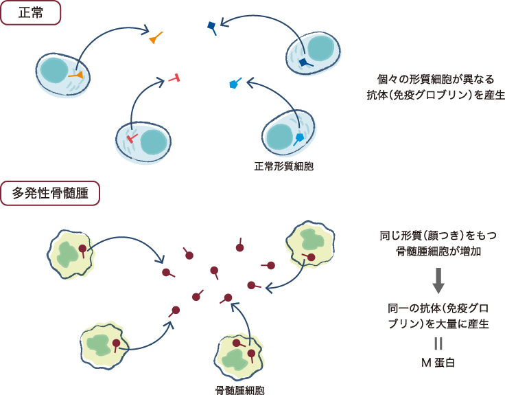 多発性骨髄腫の診療指針2024 第6版 |