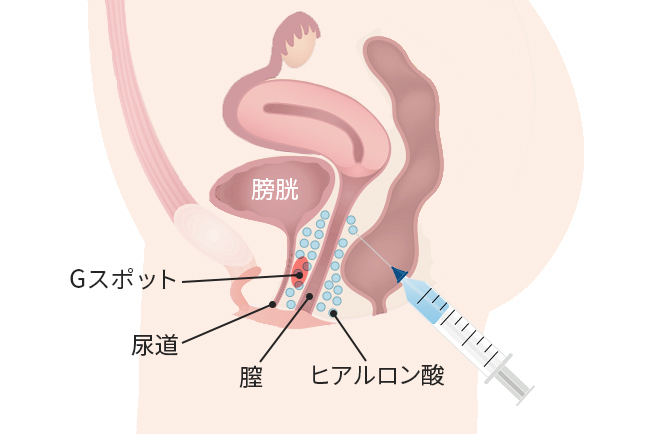 4つの秘密スポットで女性を喜ばせるテクニック術: 知らなきゃ損！Gスポット、Aスポット、Cスポットの極意 |