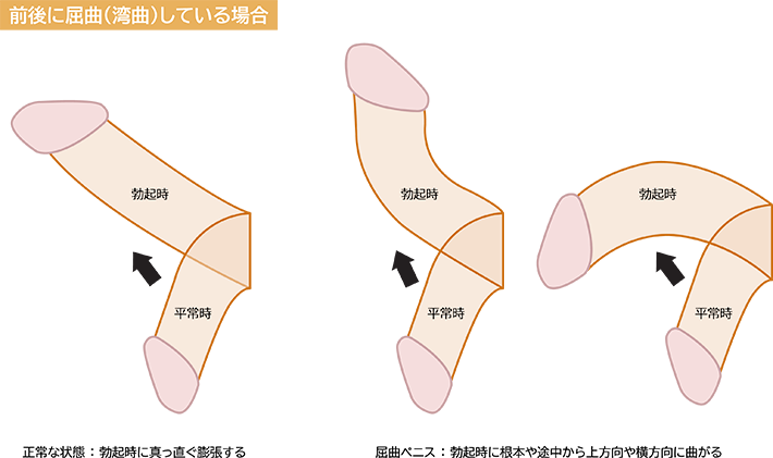 横並びのちんこ比べと言うと正面向きのやつでしょうか？」 →はい！正面向きの方でお願いします！🙇‍… | 草葉陰樹