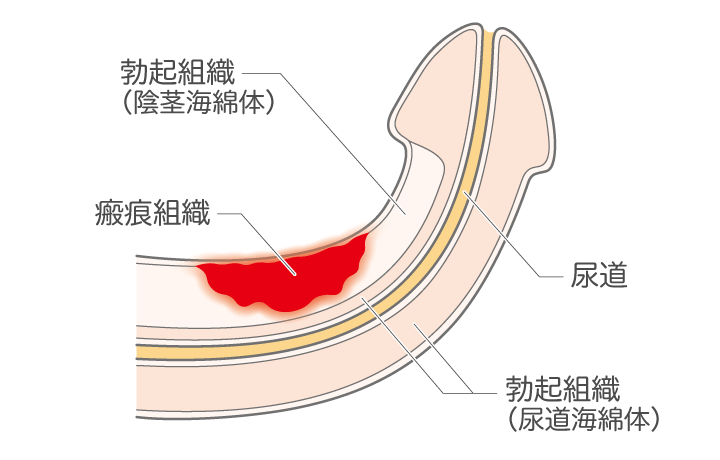 H(エッチ)にはどれくらい時間をかけるのが正解!?「私たちが、Hのお悩みに答えます」 メンズノンノウェブ | MEN'S