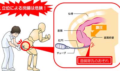 世界のウケ事情】みんなどうやってお尻をキレイにしてるの？