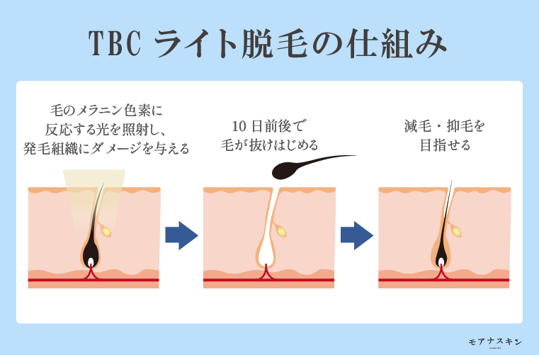 公式】エステティックTBC (@tbc_aesthetic) • Instagram photos