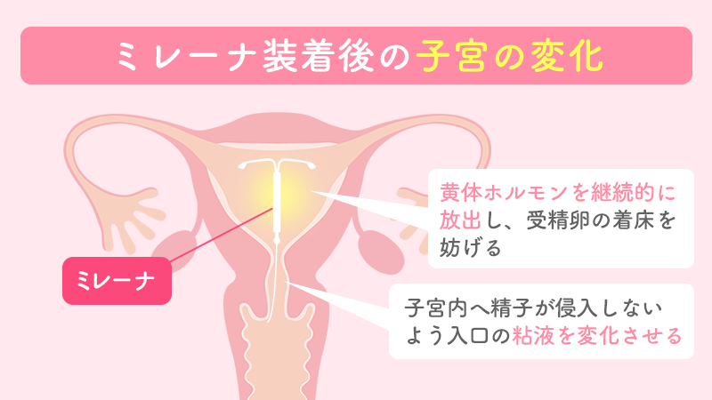 コロナ下3度目の夏へ…「最新暑さ対策グッズ」冷感マスクやネッククーラー "身に危険及ぼす"暑さに備え｜FNNプライムオンライン