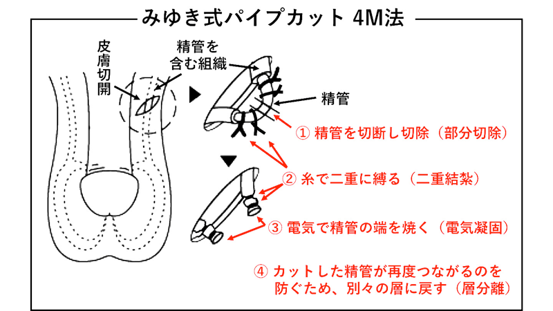 暮らしと医療機器