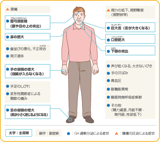 風俗嬢は巨根な客をどう思う？デカチン・粗チンどっち派？