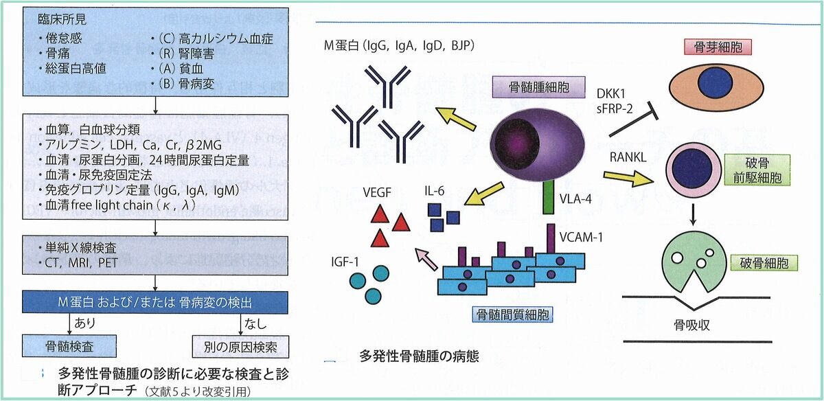多発性骨髄腫 | 江東区・亀戸駅・イースト血液内科クリニック