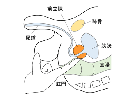 前立腺の病気 - ふじもと医院