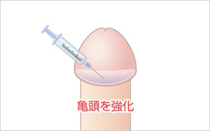 早漏改善するにはどうすれば良いですか？ やっぱりチントレですか？ スクワットとかの筋トレですか？