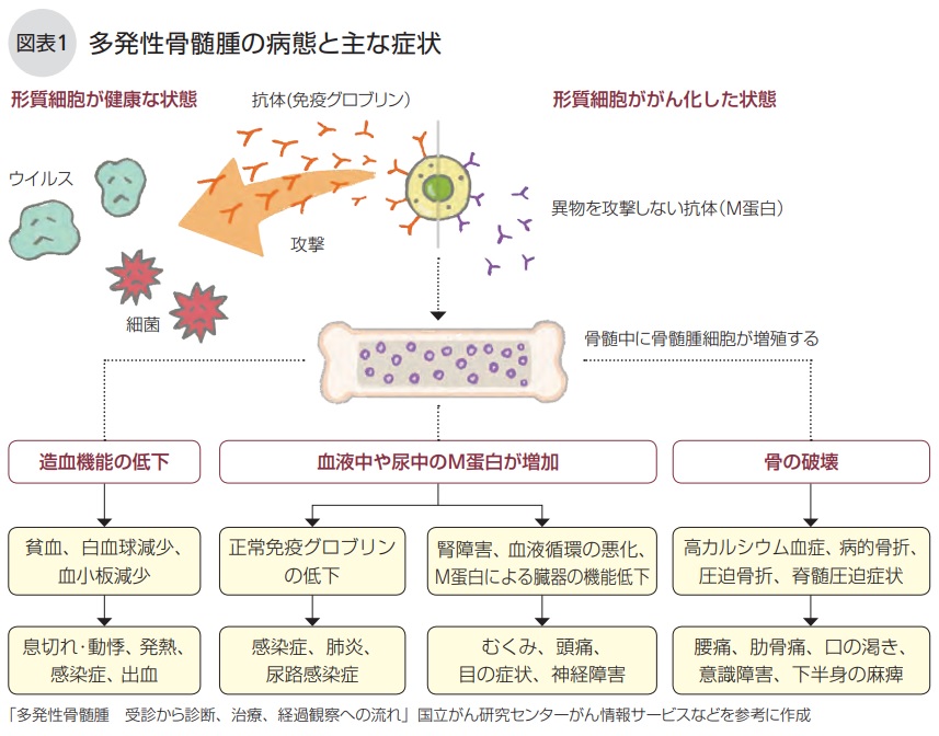 がん情報サイト | がん情報各論：[患者さん向け]形質細胞腫瘍（多発性骨髄腫を含む）の治療（PDQ®）