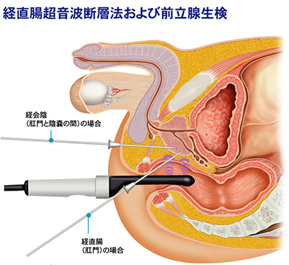 S女向け】アナルプレイで強制メスイキさせるコツ | 責められM男のための情報サイト|痴女出会いナビ