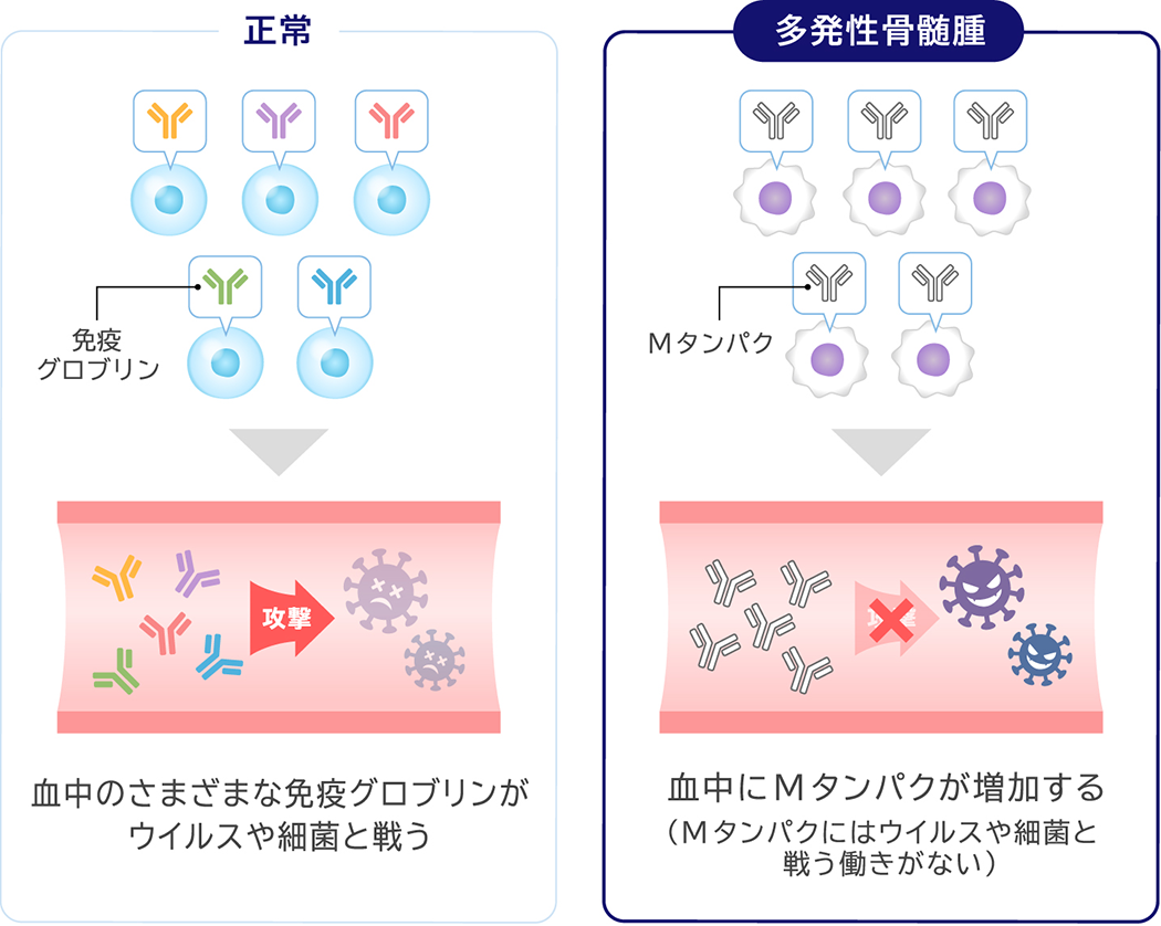 11/19(木)受診日～誕生日 | 私の中の多発性骨髄腫