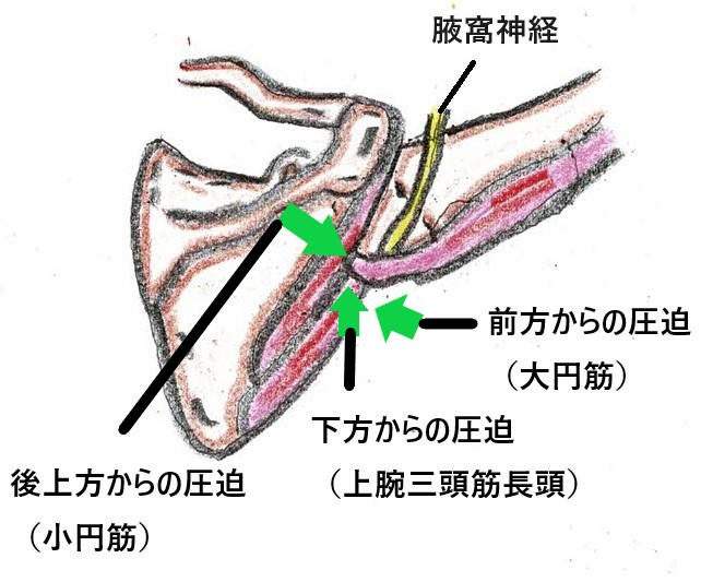 骨折“手術後”の歩きにくさ・動き・痛みを改善したい方向け『骨折専門リハビリコース』を開始 | 株式会社ワイズのプレスリリース