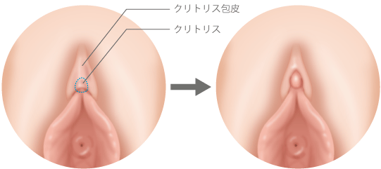 無修正 クリトリスを大きく勃起させてオナニーをする変態 貴方のチンポをジンジンさせるエロい喘ぎ声と絶頂