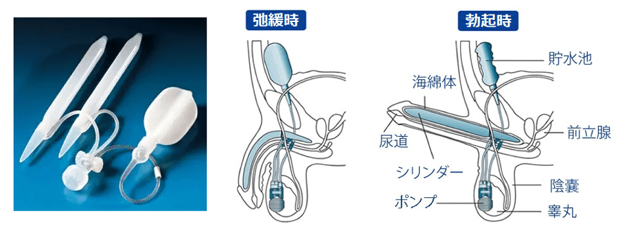 縛るか縛らないか-コンドームの後始末 1-[ビバノン循環湯 38]