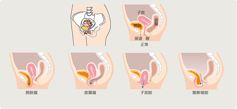 女性器について、正しい知識を持ちましょう | ゆかりレディースクリニック