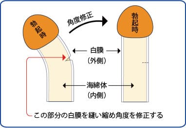 女性は太いちんこの方が気持ちいいの？体験談から理想の太さを調査｜風じゃマガジン