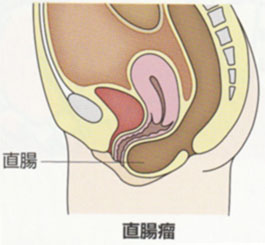 はじめましてわたしは肉便器です(>_<) - 女装肉便器くみこ