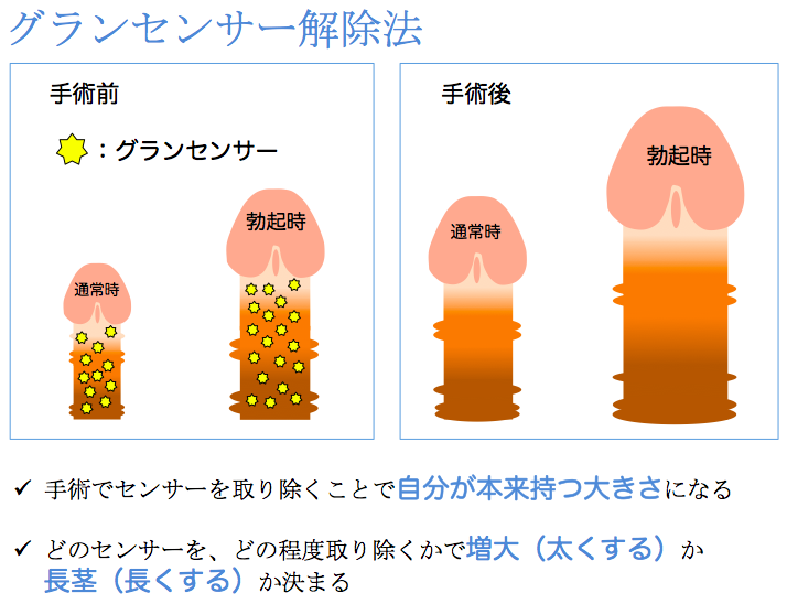 【カリ高】ペニスの亀頭特化カリトレ・チントレ方法は本当に効果があるのか解説！