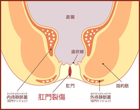 アナルセックスエロ画像】そのうち痔になりそうな肛門でセックスしてるお姉さん達！（47枚）※05/09追加 | エロ画像ギャラリーエロ画像ギャラリー