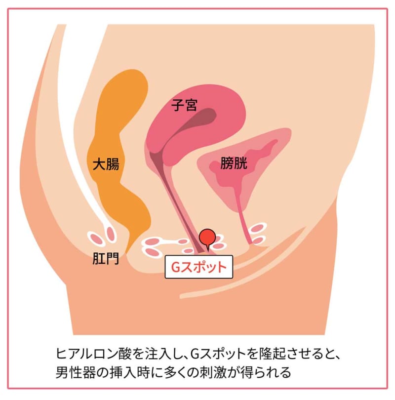 Gスポットはない人もいる!? 見つけ方と感じる方法を婦人科医がレクチャー｜GLITTER | グリッターな人生を！(スタイルマガジン『グリッター』)