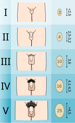 カリ首 - Wikipedia