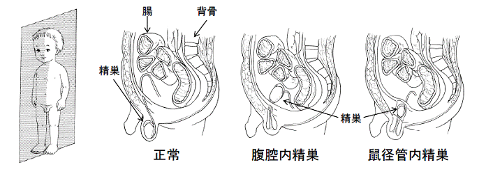 金玉解説]公式が出した激ムズ縛りを公式金玉が一分で解説#フォートナイト #ゆっくり実況 #ゆっくり解説 #fortnite |