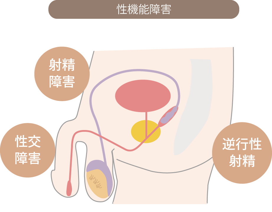 血精液症について（精液・精子に血液が混じる） | 東京泌尿器科クリニック上野