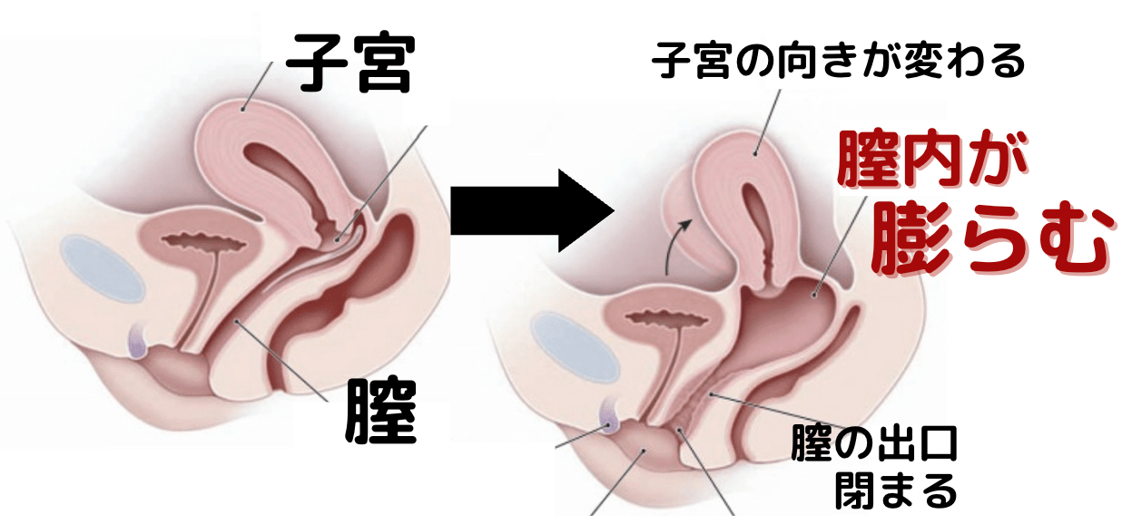 射精を完全に止めたらオトコの体はこうなってしまいます・・・