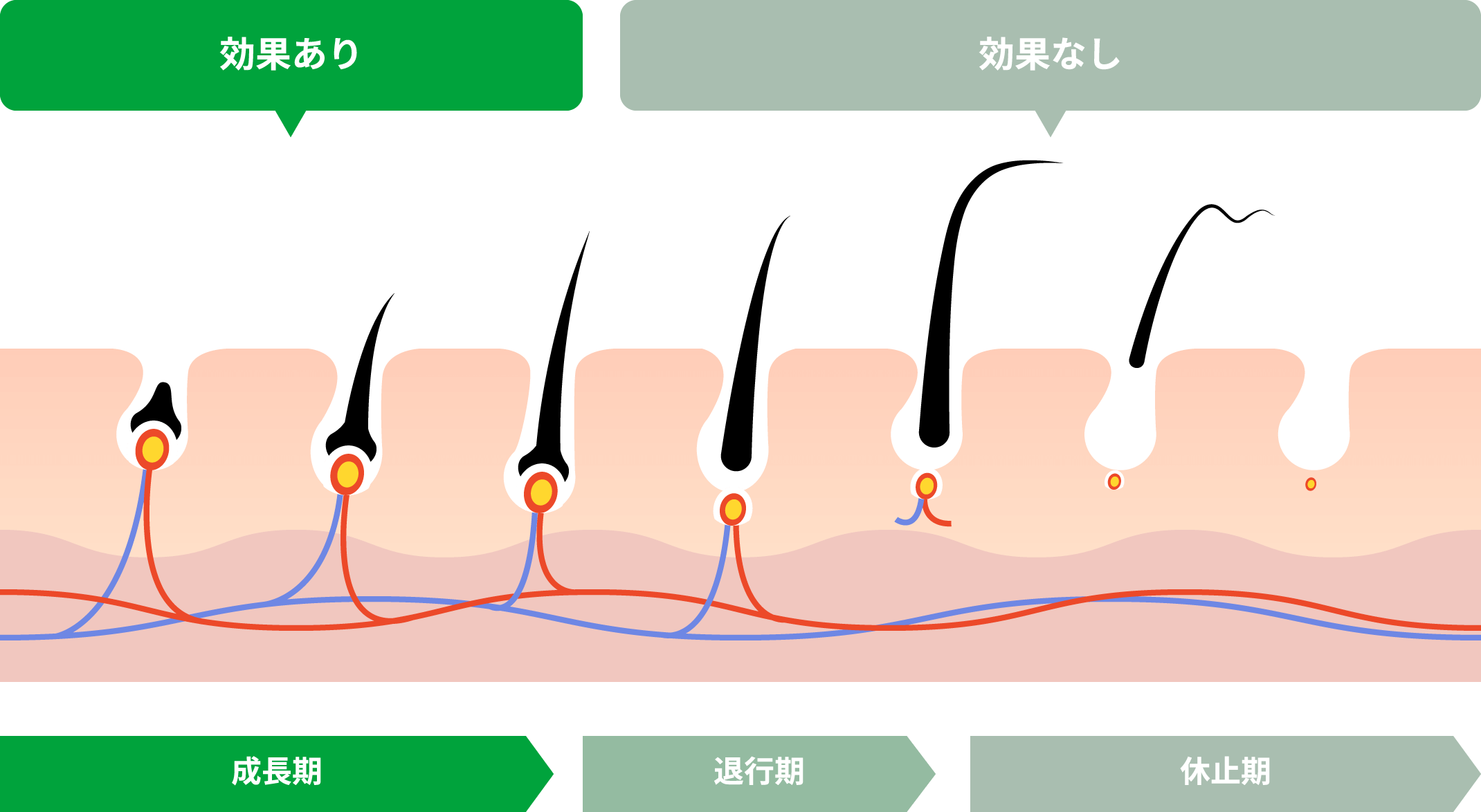 木津川市でメンズ脱毛がおすすめの人気サロン・クリニック特集 - メンズタイムズ