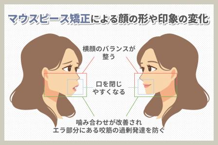 子供の歯並びのためにできること。指しゃぶりは？食事方法は？矯正は早めがいい？ | 本田歯科クリニック