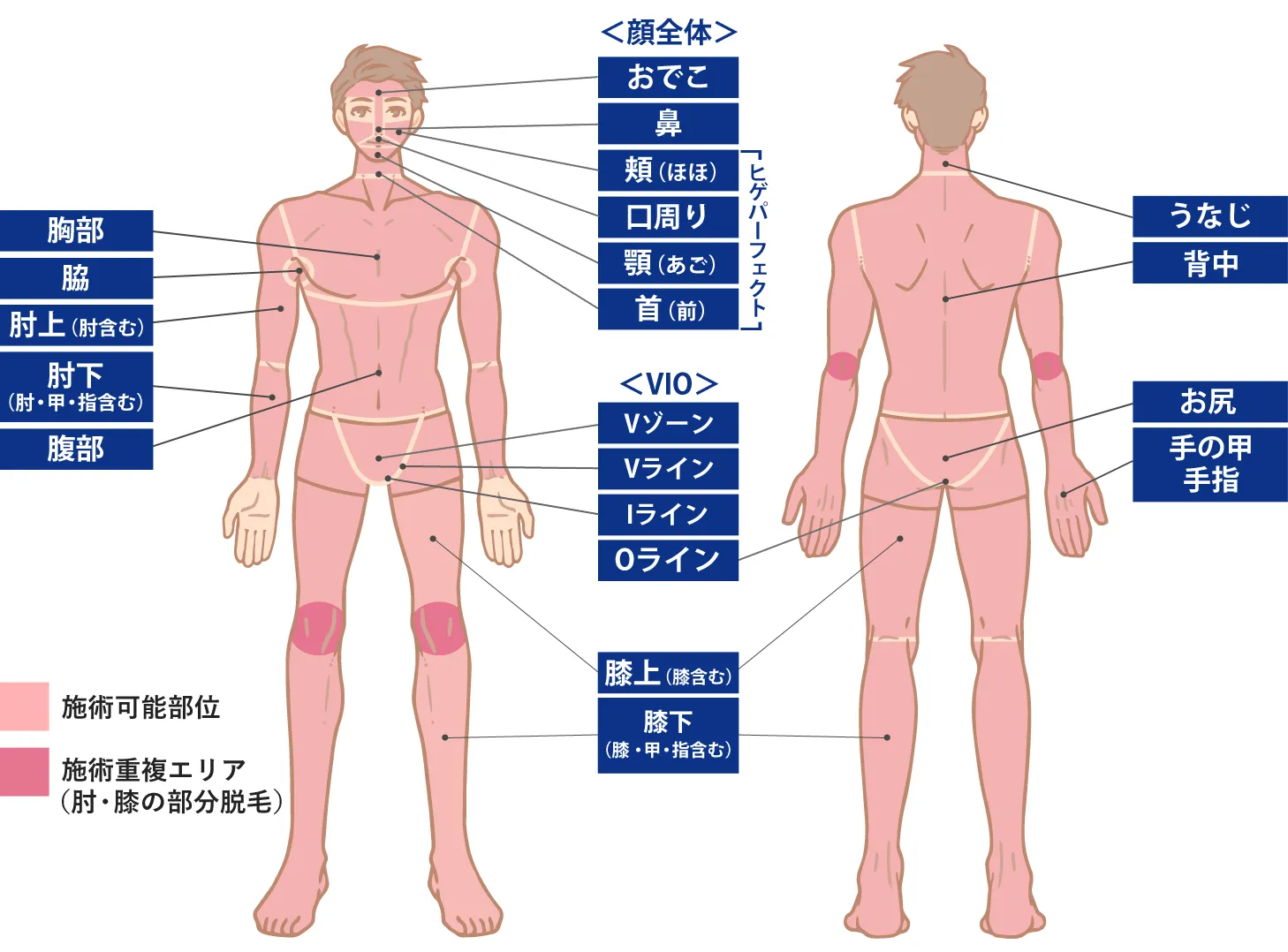 2024年最新】加古川で人気のメンズ脱毛おすすめサロン・クリニック10選 | Midashinami 身だしなみ