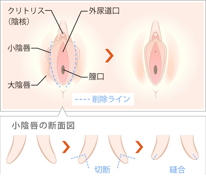 Amazon | クリの皮むき 栗の皮むき 夏みかんの皮もむける