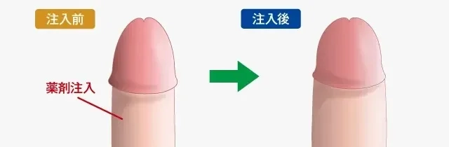 ペニスの大きさ平均は13cm！女性の理想サイズはさらにデカい！？｜薬の通販オンライン