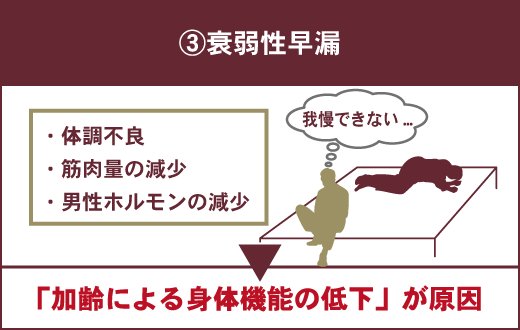 男性が悩むオシッコ「ちょび漏れ」の対策法とは？ （2ページ目）：誰にも言えない…オトコのお悩み相談室：日経Gooday（グッデイ）