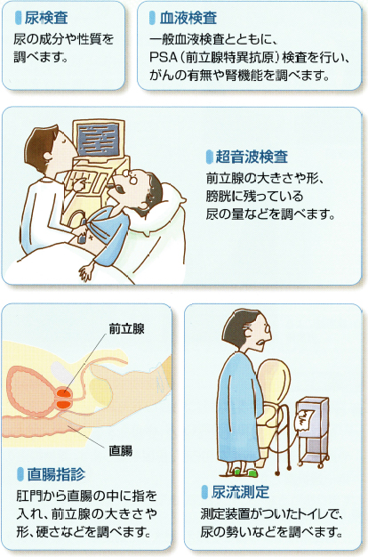 前立腺責めのやり方とコツ！気持ちいい前立腺マッサージの方法をイラストで解説