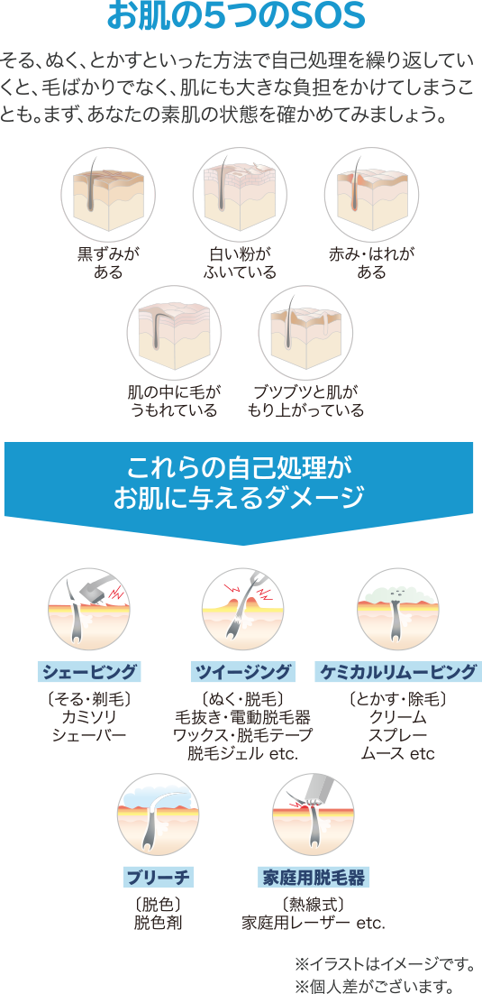 パナソニックの脱毛器のメンズに関する口コミは？光エステスムースエピES-WP9A・WG0A - ちいさな暮らし