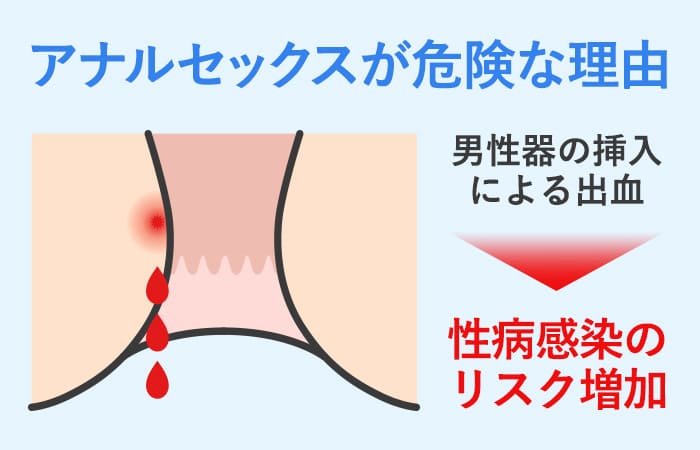 アナルセックスのやり方！準備と初めて開発 - 夜の保健室