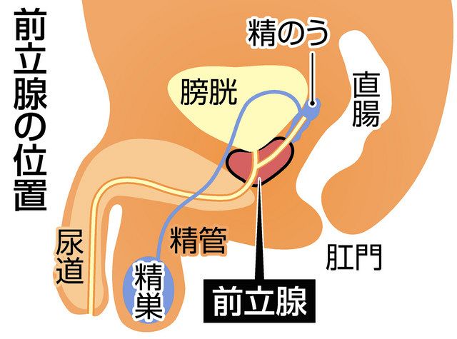 前立腺肥大症とは？ | 前立腺肥大症.com