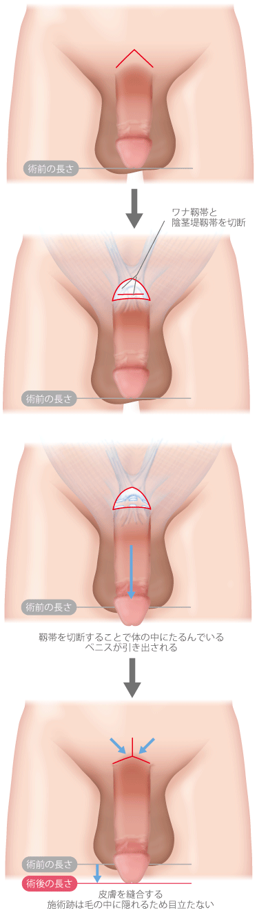 症例27 小帯について (動画有り) |