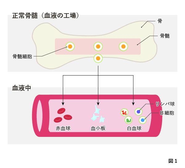 多発性骨髄腫の染色体および遺伝子異常：t（4；14）, t（14；16）（q32；q23）（p16；q32）転座, 13q欠失,  17p欠失は高リスク型