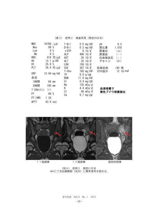 幼い男の子がなりやすい亀頭包皮炎 | 医療・健康Tips