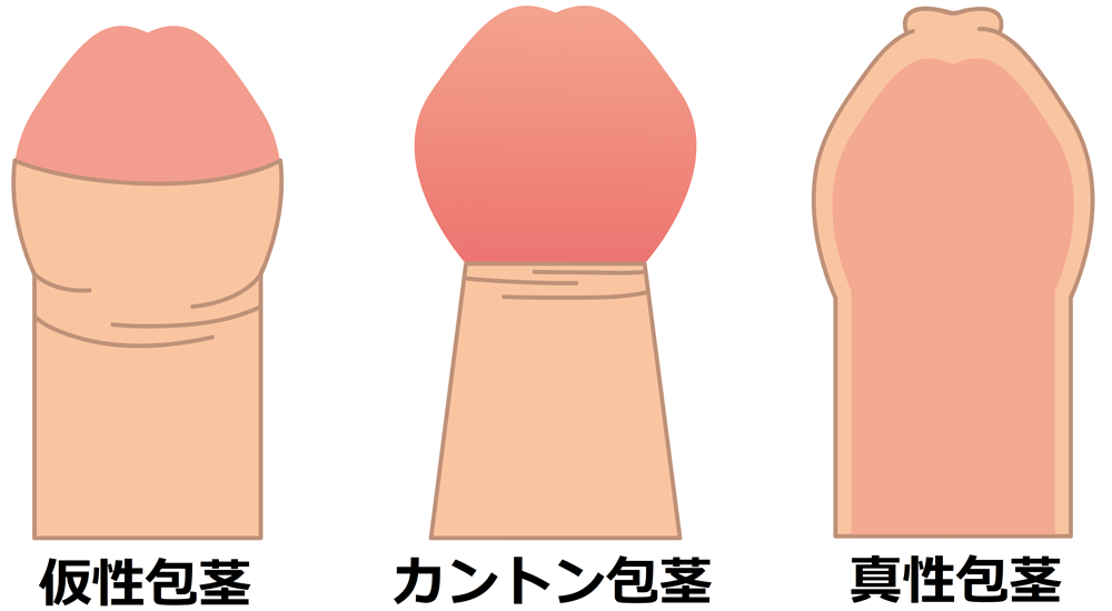 メスに男性器？そこから出産！？ ブチハイエナのリスクしかない進化