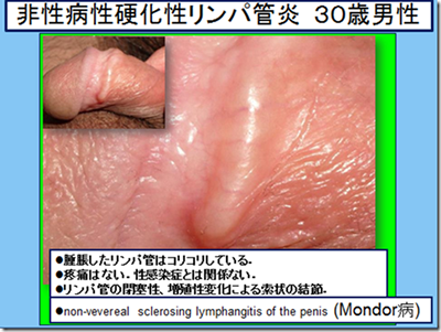 カリ高】ペニス亀頭特化チントレ４選【図解・動画解説】 | セクテクサイト