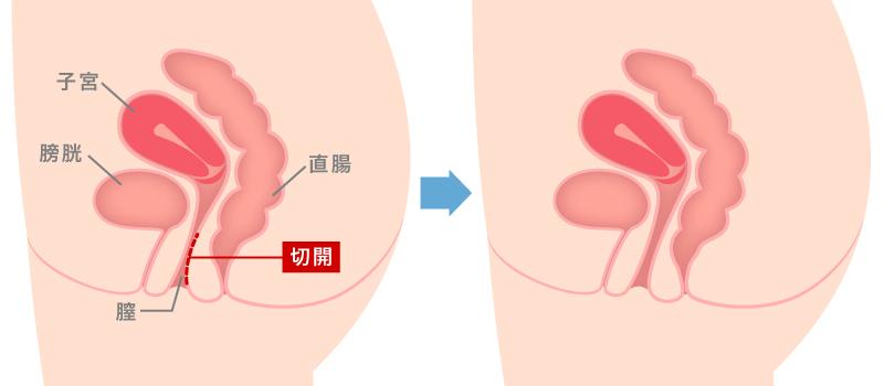 Amazon.co.jp: 膣拡張器観察キット HDカメラ