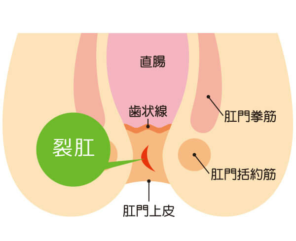 伝説のヤリチンVS鉄壁の尻穴 / コミックス /