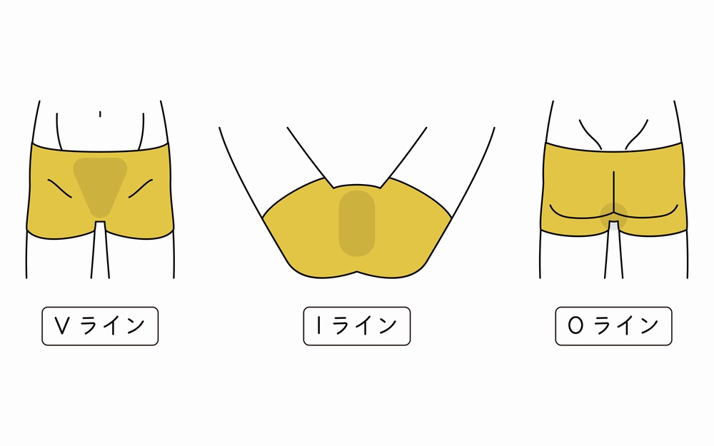 男性アンダーヘア（チン毛）の処理・調節方法とおすすめデザインを紹介 | メンズ脱毛百科事典