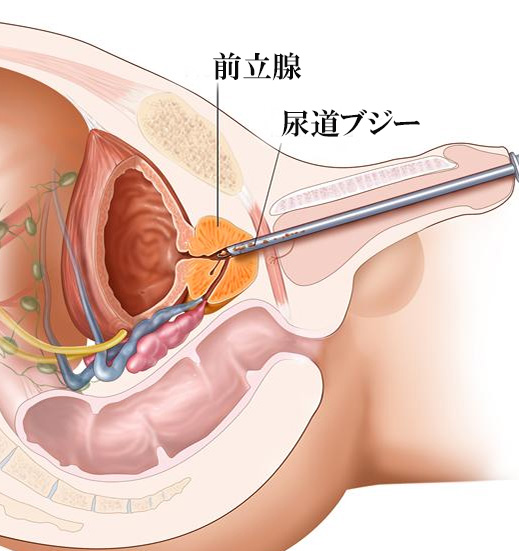 ポルチオとは？位置や開発方法、ポルチオセックスのやり方- 夜の保健室