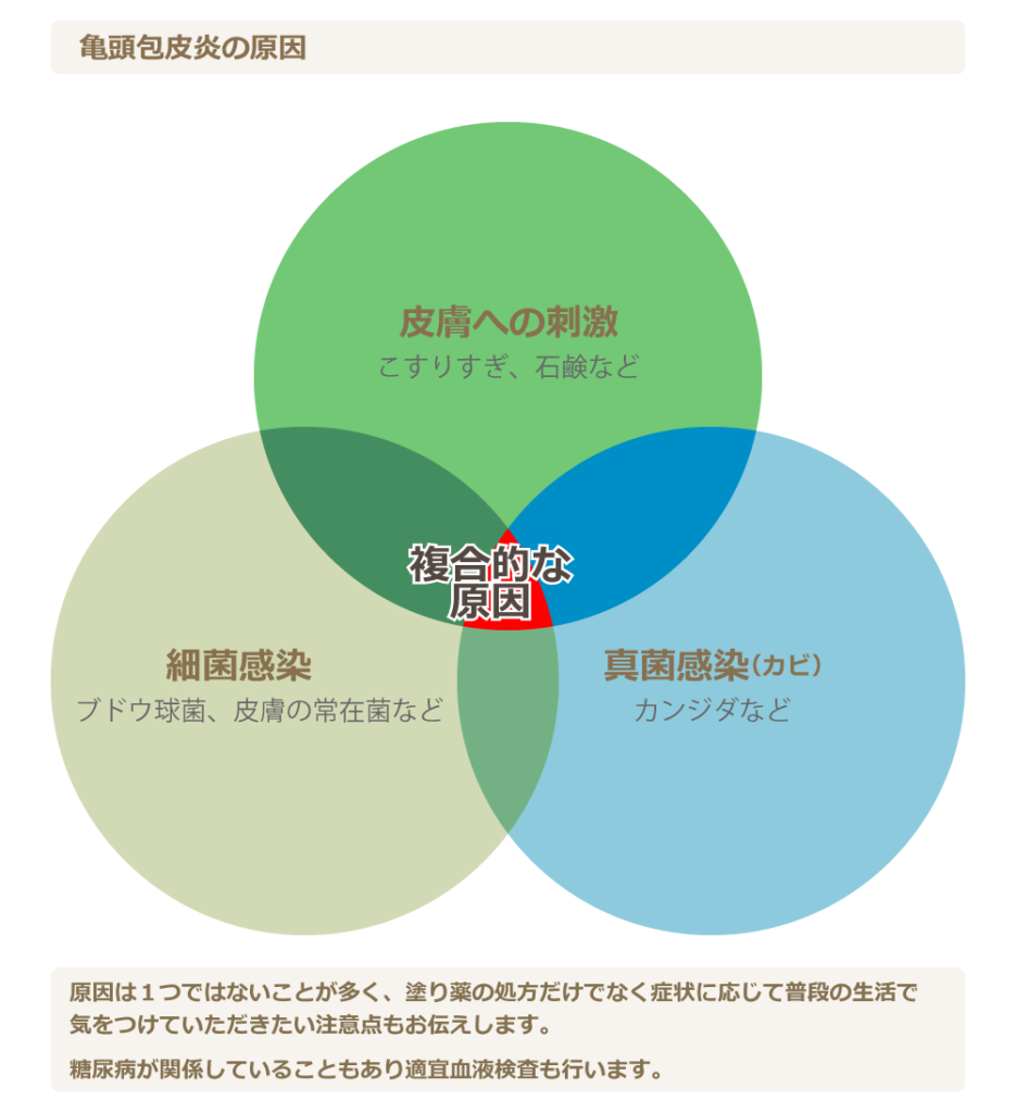 あの『ペニスの形』には意味があるの？ちんこの亀頭があの形の理由【ラブコスメ】