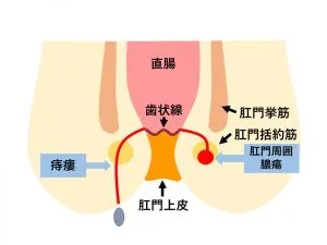 縦割れアナルって直すことできるの？