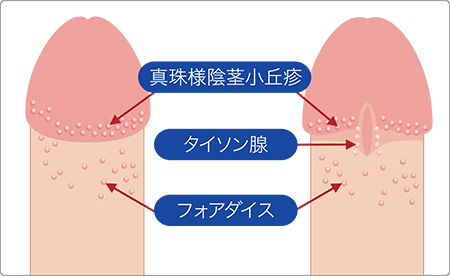 真珠入りチンコで３P初体験談 : エロ漫画無料アダルト裏モノJAPAN